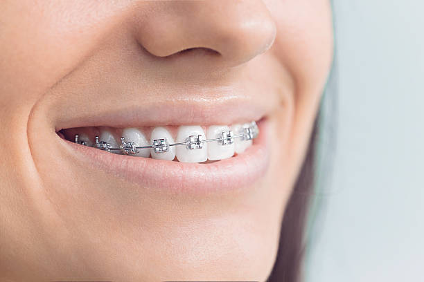 Trusted De Kal, TX Holistic Dental Care Services Experts